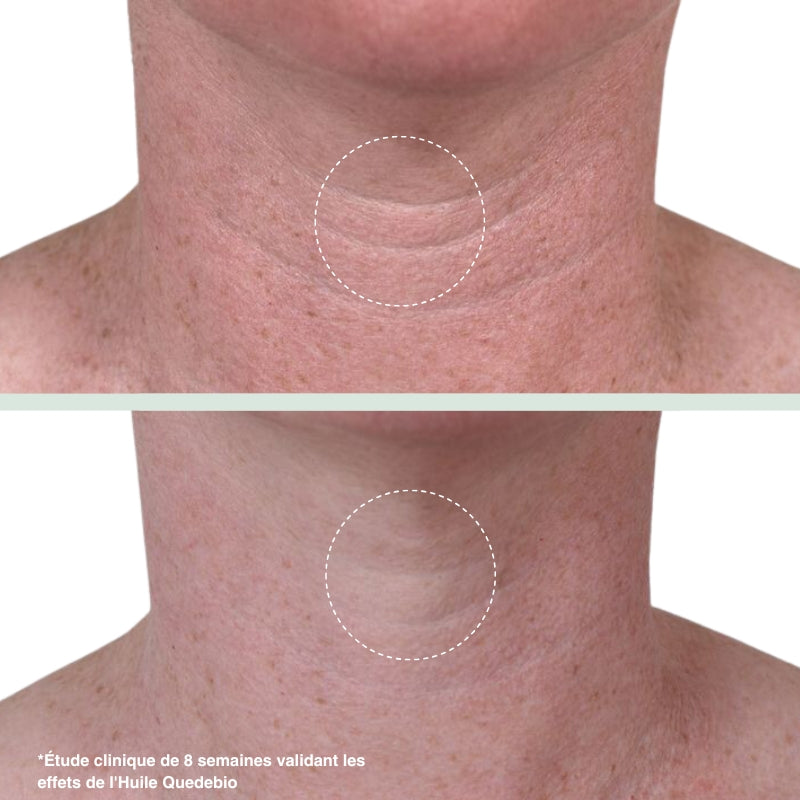 The Real 100% Pure and Organic Prickly Pear Seed Oil - 30ml