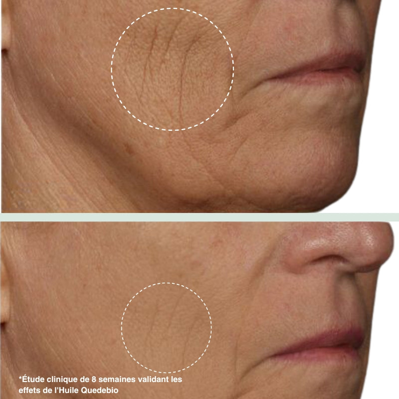 The Real 100% Pure and Organic Prickly Pear Seed Oil - 30ml