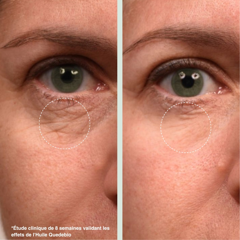 The Real 100% Pure and Organic Prickly Pear Seed Oil - 30ml