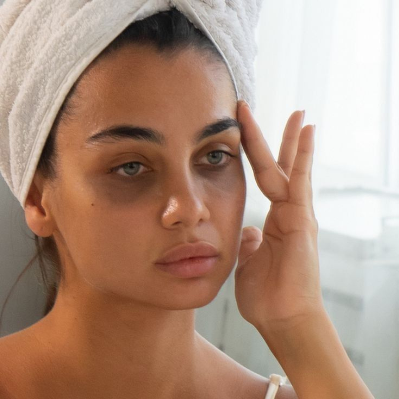 Femme avec cernes visibles sous les yeux, signes de fatigue, atténués naturellement avec l'huile de figue de barbarie Caudabio