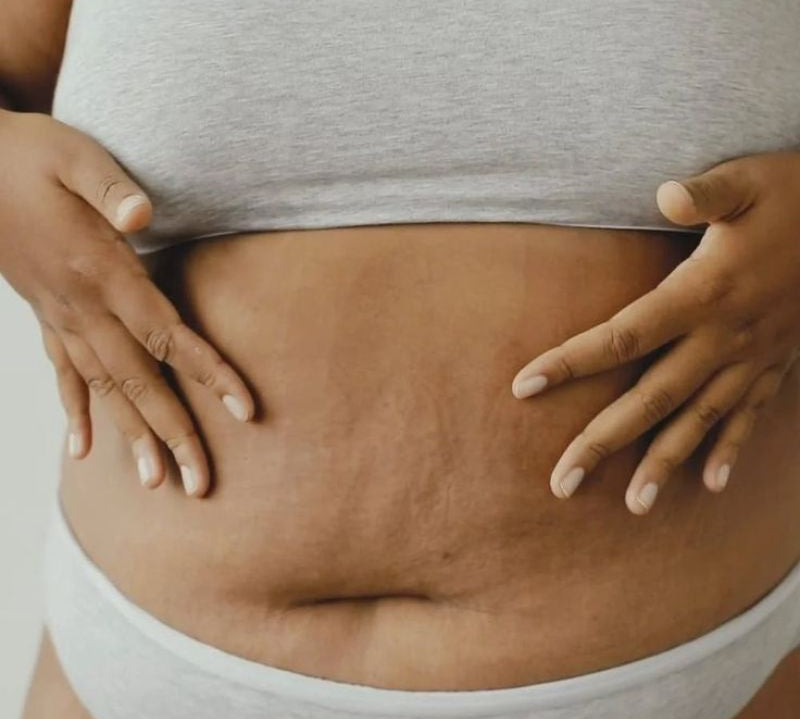 La peau des cuisses et du ventre peut se relâcher avec l’âge