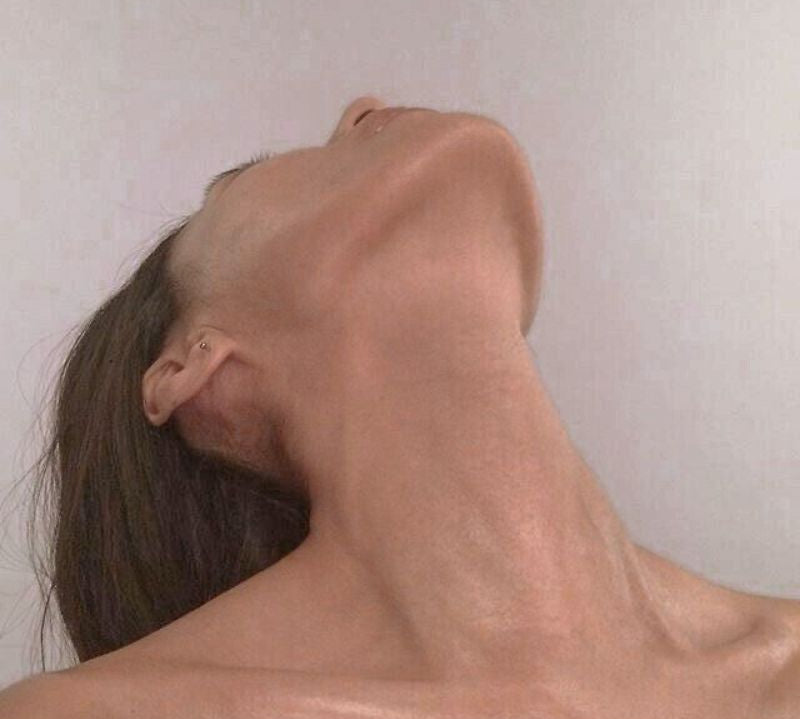 relâchement cutané du cou est un signe visible du vieillissement