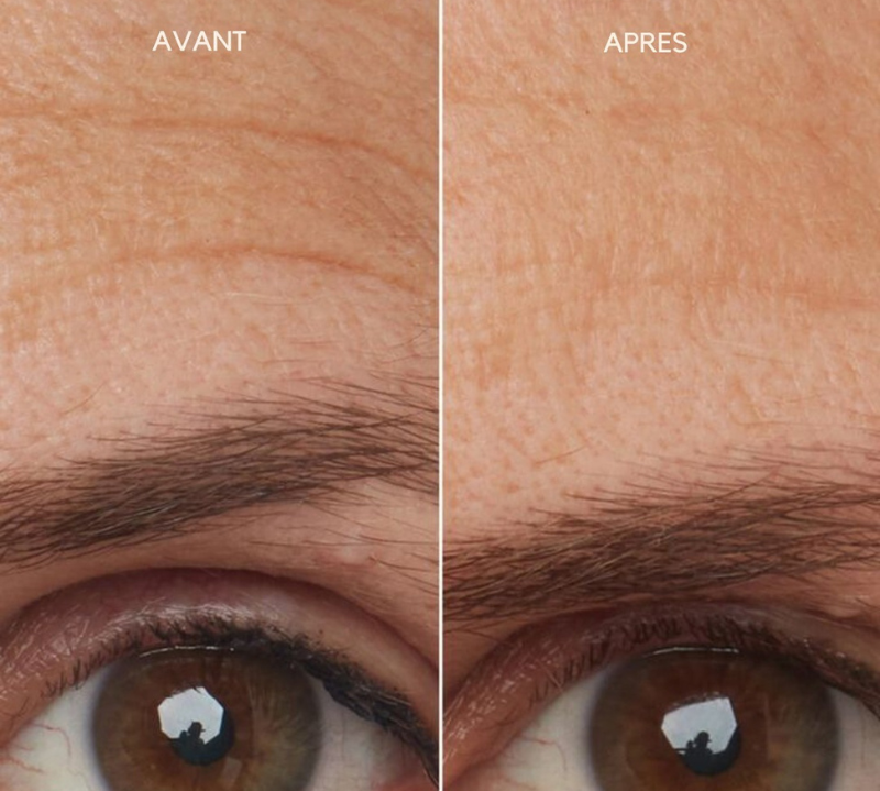 Un visage transformé en 30 jours avec Caudabio