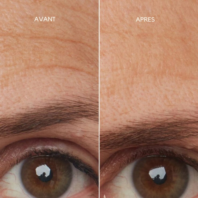 Un visage transformé en 30 jours avec Caudabio